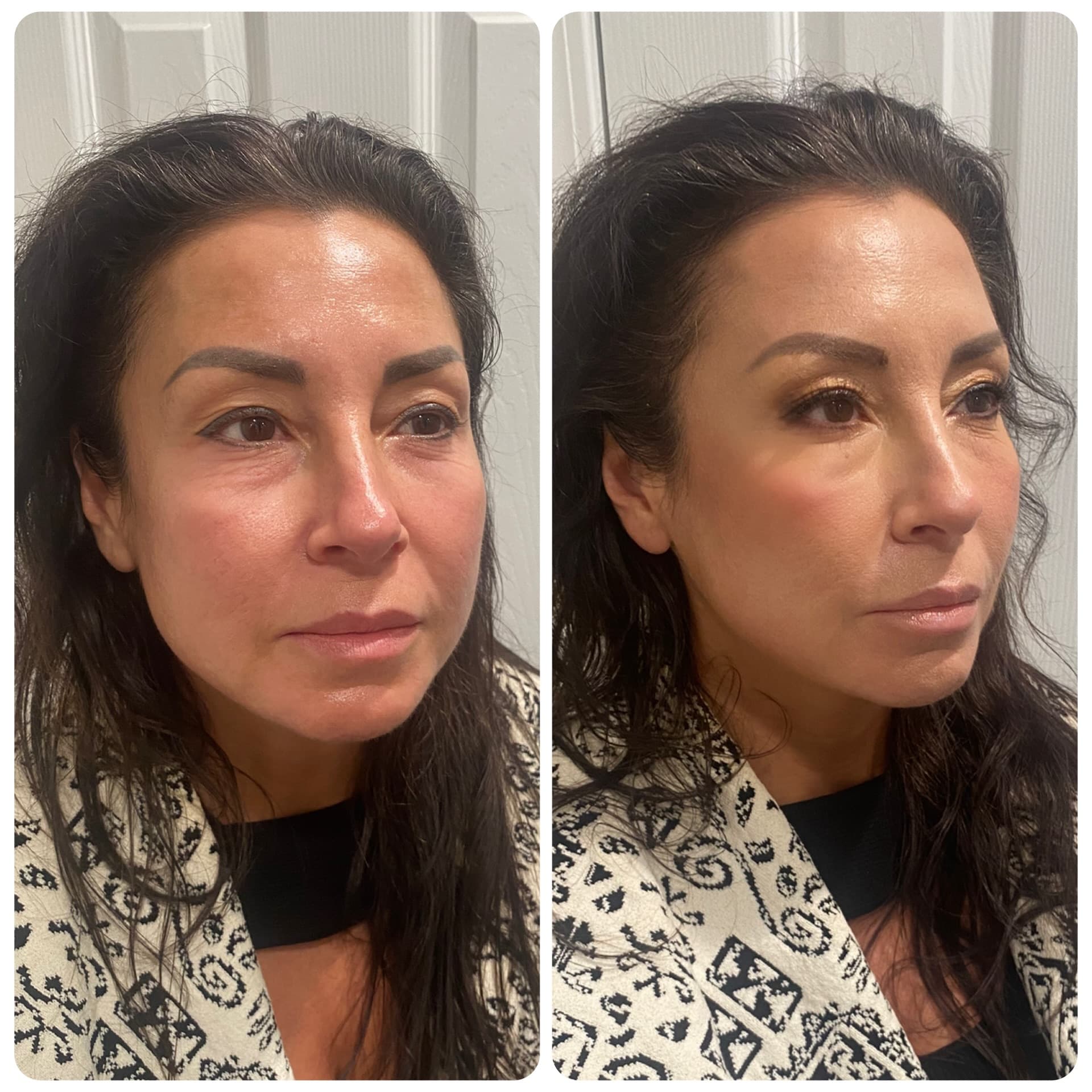 Makeup before and after at Ariava Medical Aesthetics