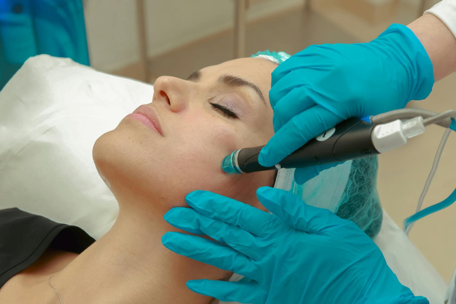 Microneedling treatment at Ariava Medical Aesthetics