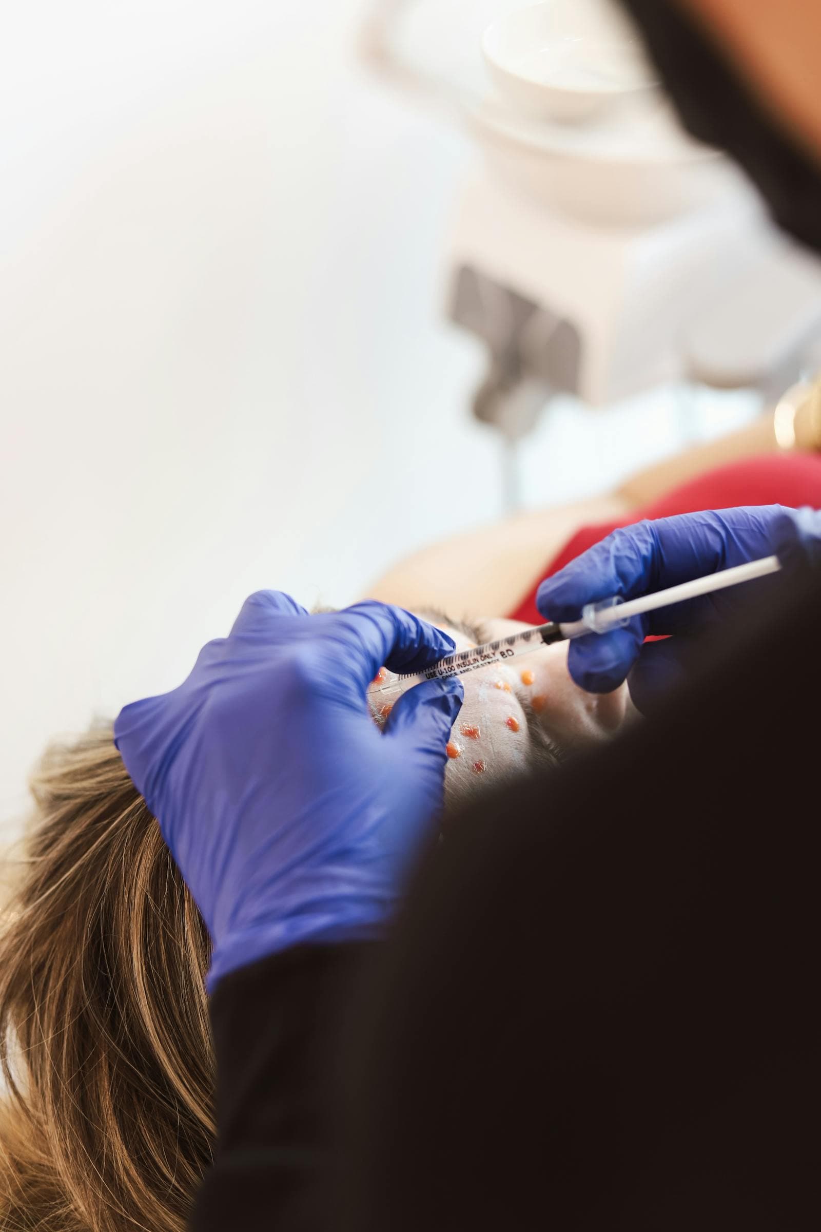 PRF Injections at Ariava Medical Aesthetics