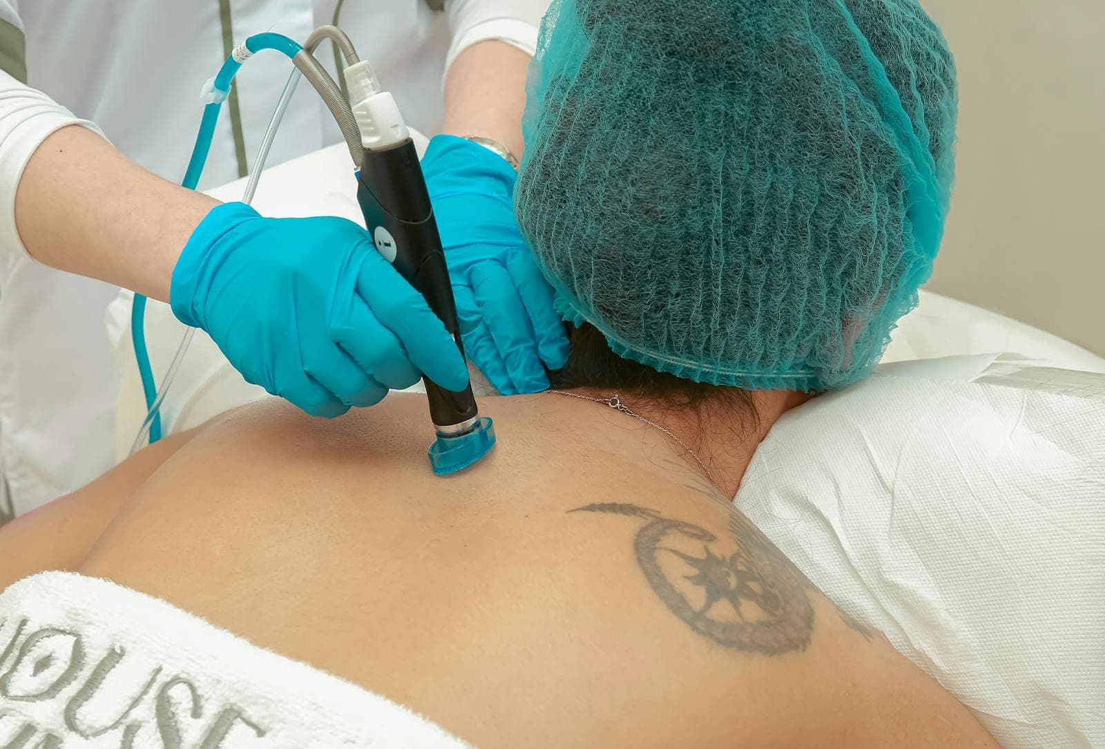 Laser tattoo removal treatment at Ariava Medical Aesthetics